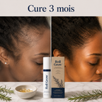 Roll Grow™ — Sérum Repousse Ciblée · Romarin & Biotine