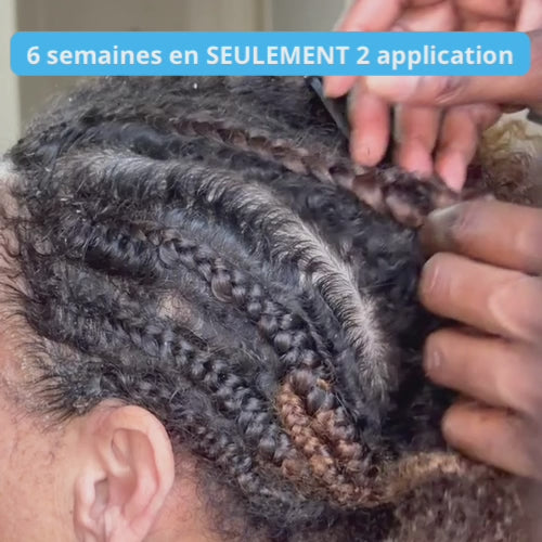 Roll Grow™ – Sérum repousse ciblée